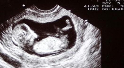 متى تسمع الحامل دقات قلب الجنين؟