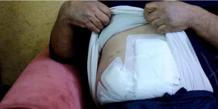 احد مصابي عملية جرش يروي تفاصيل جديدة في عملية طعن السياح .. تفاصيل