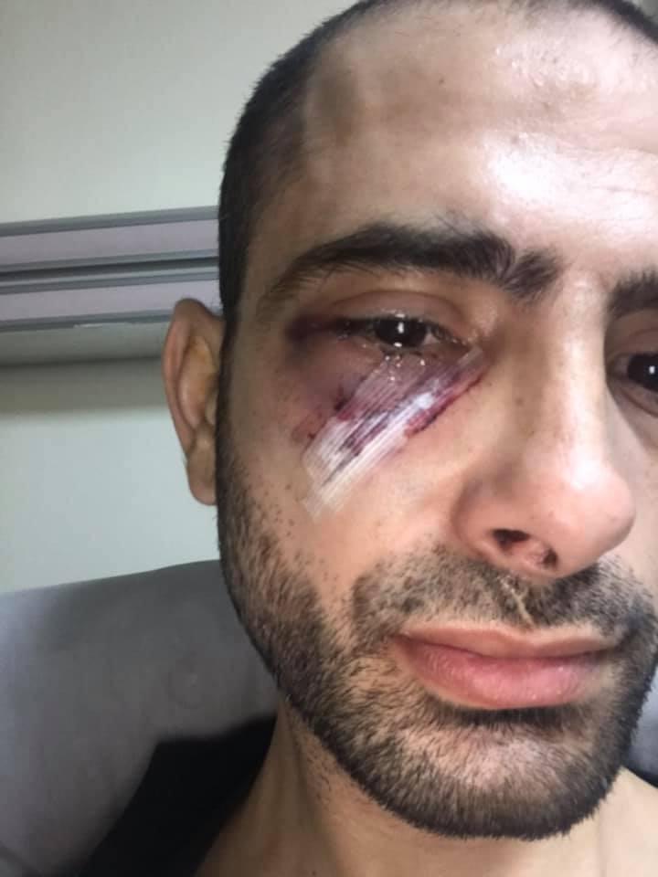 الاعتداء على محصل مياه في منطقة حي نزال