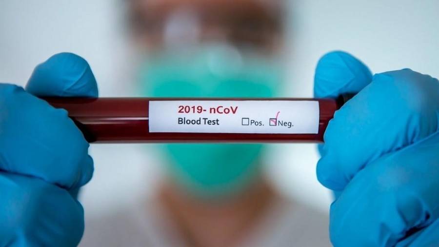 إجراء صورة طبقية أخيرة للمصاب بكورونا اليوم قبل مغادرته المستشفى