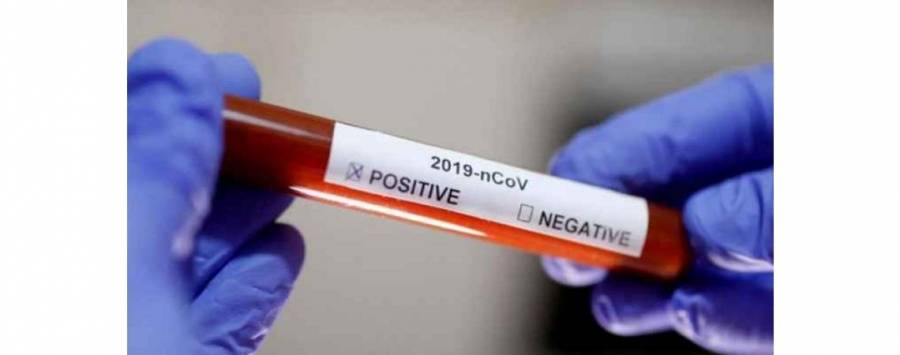 الهياجنة: فريق استقصاء الوباء تجمع 70 عينة من الرمثا والوضع مطمئن