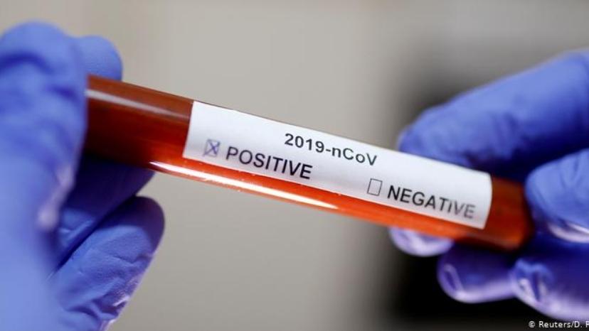 عينات سوق العارضة ال 29 سلبيه ولا اصابات بكورونا