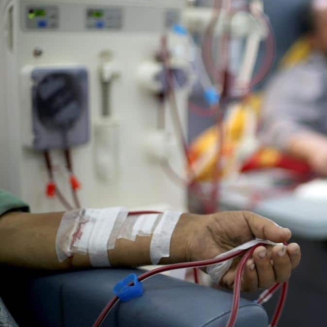 الصحة:تجديد إعفاءات غسيل الكلى والسرطان لأبناء غزة تلقائيا