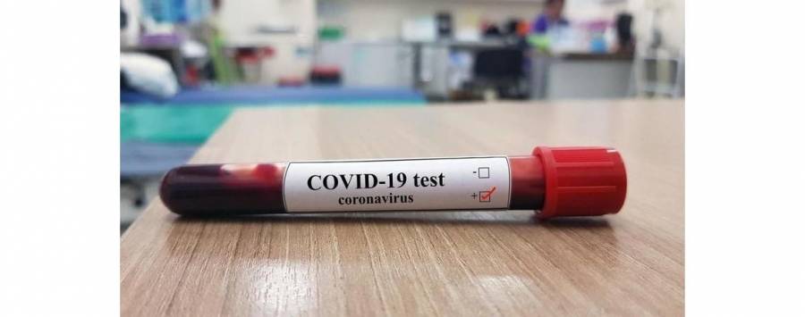 نتائج فحص مخالطي المتوفى الأخير بكورونا تظهر اليوم أو غدا