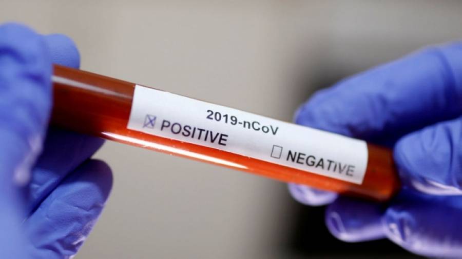 هياجنة: فحص ال PCR هو الوحيد المعتمد لتشخيص حالات الكورونا