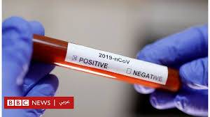 اربد: ارتفاع العينات السلبية لمخالطي السائق المصاب بكورونا إلى 292