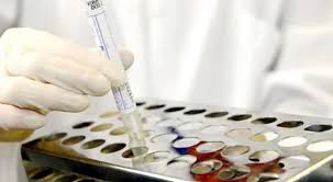 نتائج فحص 200 عينة من مخيمي الزرقاء والسخنة سلبية