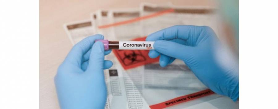 نتائج سلبية لفحوصات 200 عينة في معان