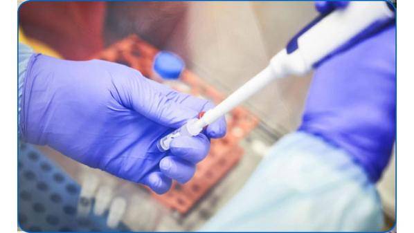 61608 فحوصات أجريت ضمن جهود التقصي الوبائي