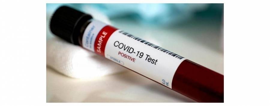 نتائج فحوصات 10 عينات من مخالطين بالزرقاء سلبية