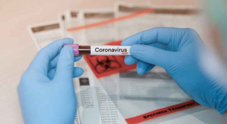 عاجل : نتائج سلبية لفحوصات الكوادر الطبية والتمريضية في إربد