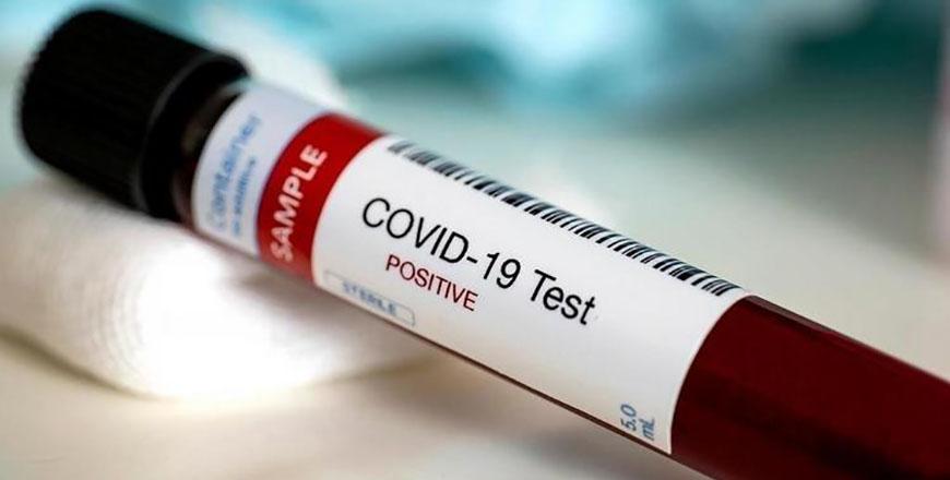 New coronavirus infections in Mafraq jump to 21 — health official