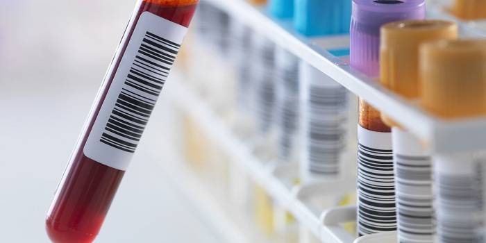 الطفيلة :إخضاع 320 عينة عشوائية للفحص