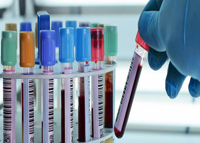 عجلون :سحب 35 عينة لمخالطي سائق شاحنة مصاب بكورونا