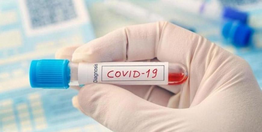 4 returning students, 2 truck drivers test positive for COVID19 on Wednesday