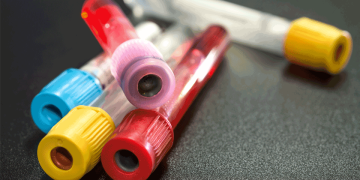 ترقب نتائج 200 عينة لمخالطي طبيب مستشفى الأميرة بسمة