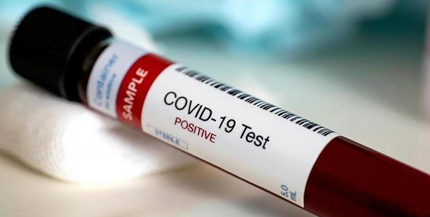 Jordan records 7 new COVID19 infections; caseload stands at 718