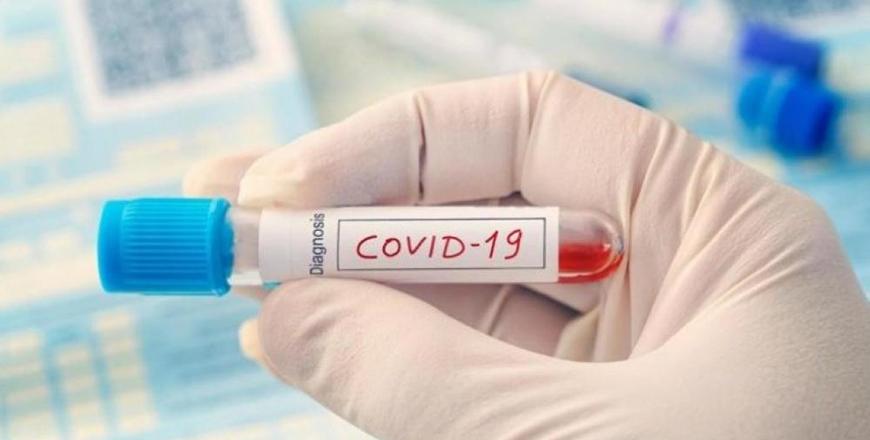 Jordan’s COVID19 caseload reaches 739 as Kingdom registers 5 new infections