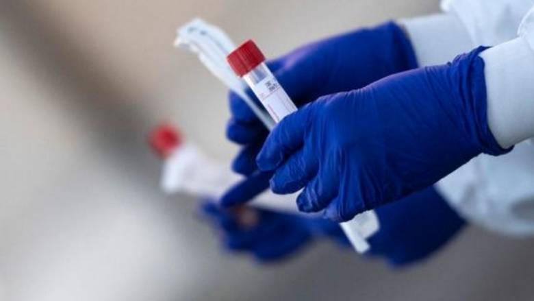 770 new coronavirus cases reported in Oman