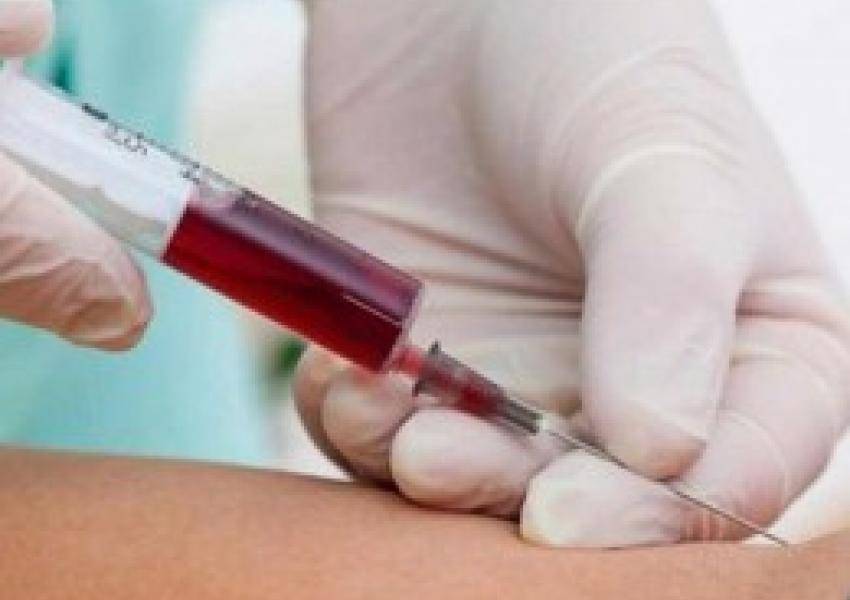 نتائج مخالطي ممرضة الرمثا سلبية