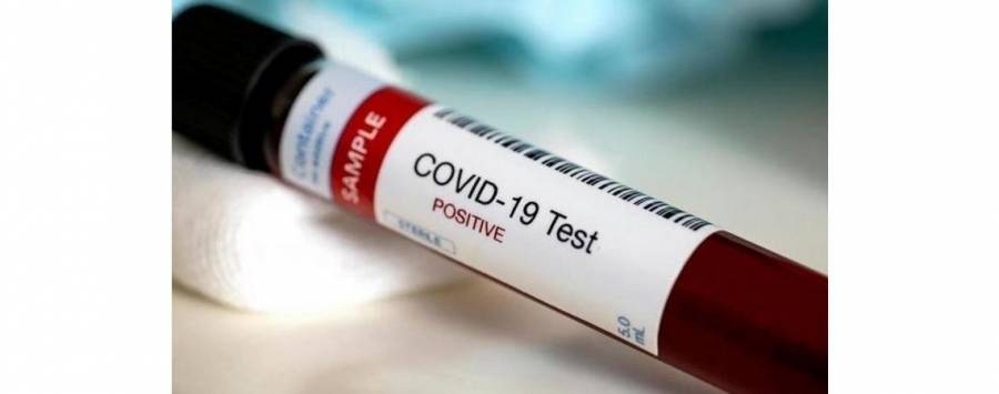 صحة البلقاء: مصابة عين الباشا قد يكون مصدرها احد المخالطين لذويها وهي تعمل في مصنع