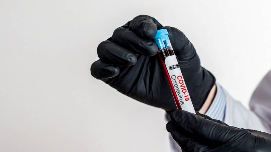 أخذ أكثر من 20 ألف عينة في جرش منذ بداية فيروس كورونا