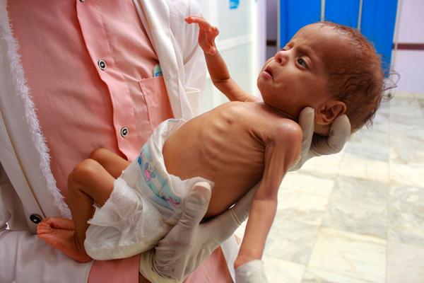 UN warns Yemen on brink of famine again