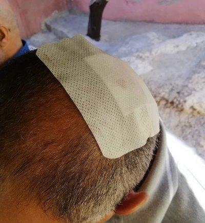 إصابة مواطن بعيار ناري بالتزامن مع إعلان نتائج التوجيهي