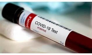 إصابة جديدة بكورونا لقابلة تعمل في مستشفى الزرقاء الحكومي وإغلاق القسم