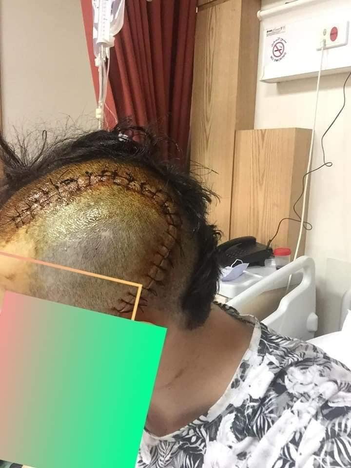 إعتداء عنيف على شاب من فارضي الإتاوات يتسبب بإصابة نافذة في الجمجمة وتحطيم مركبته