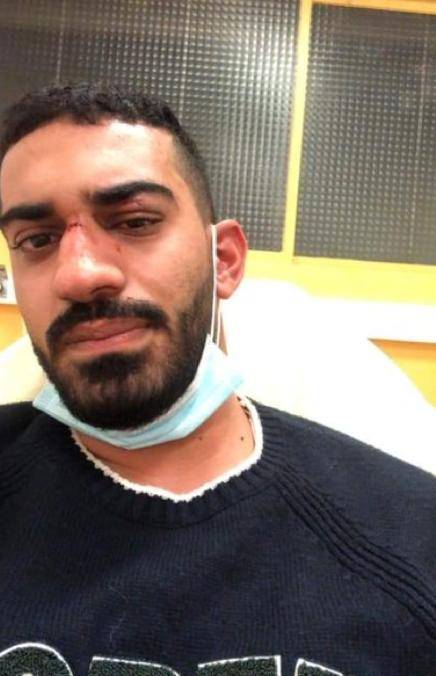 تعرض شاب أردني وشقيقته الى اعتداء  في فرنسا... تفاصيل