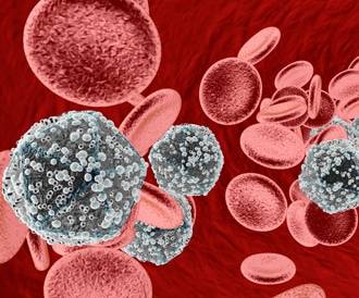 تسجيل 21 إصابة جديدة بـالإيدز في الاردن العام الحالي