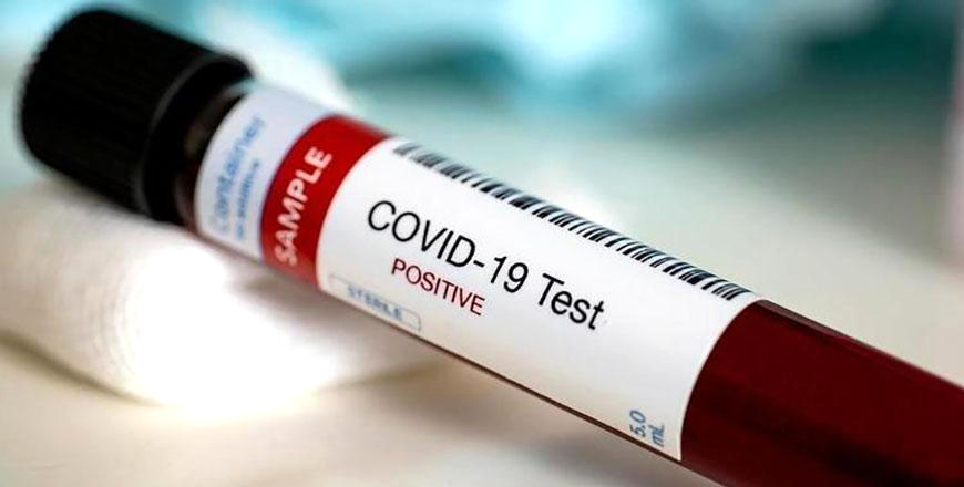 51 COVIDrelated deaths, 4,187 virus cases recorded Tuesday