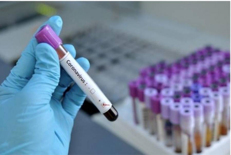 سُجِّلت (3591) حالات إصابة بفيروس كورونا المستجدّ