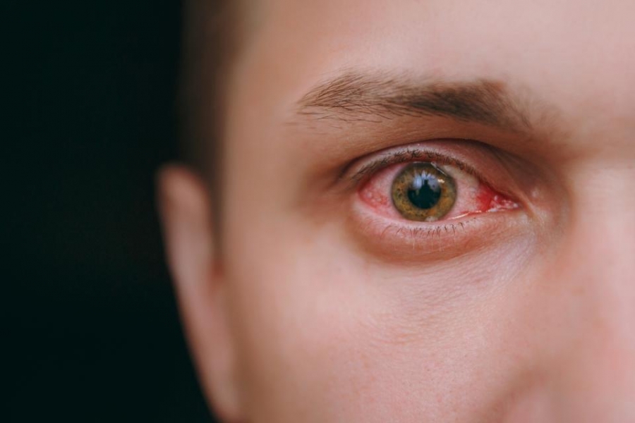 دراسة: فيروس كورونا ينتشر في أنسجة العين البشرية بعد الوفاة