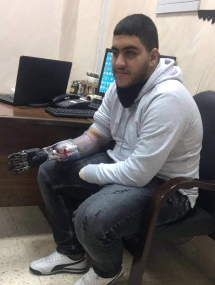 فيديو مؤثر :فتى الزرقاء صالح يتدرب على استخدام الأطراف الصناعية بعد الجريمة البشعة بحقه