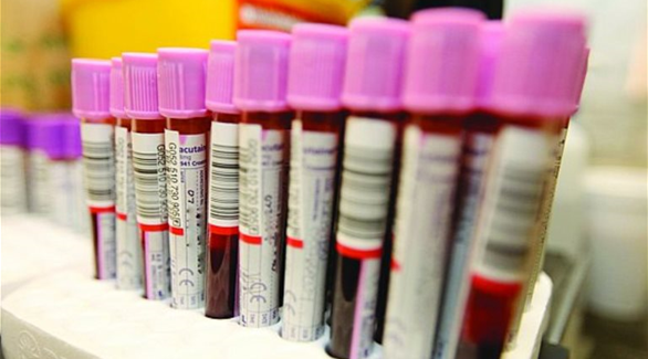 وزارة الصحة : كلفة فحص الاجسام المضادة في المختبرات الخاصة 10 دنانير