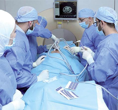 KHCC first in Kingdom to perform cryoablation for kidney tumour