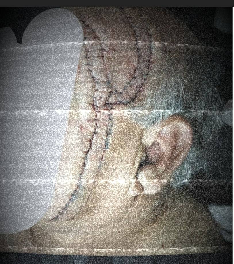 مجهول يعتدي على ستيني بواسطة أداة حادة في محافظة اربد