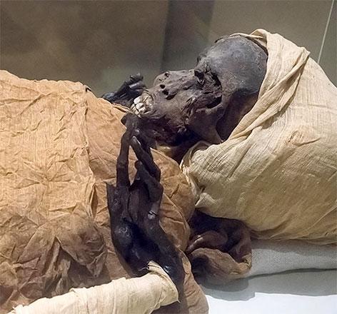 Egypt autopsy offers new clues 3,600 years after murder