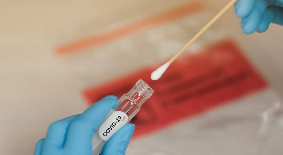 مصدر طبي ينفي فقدان المئات من عينات فحوصات كورونا بالسلط