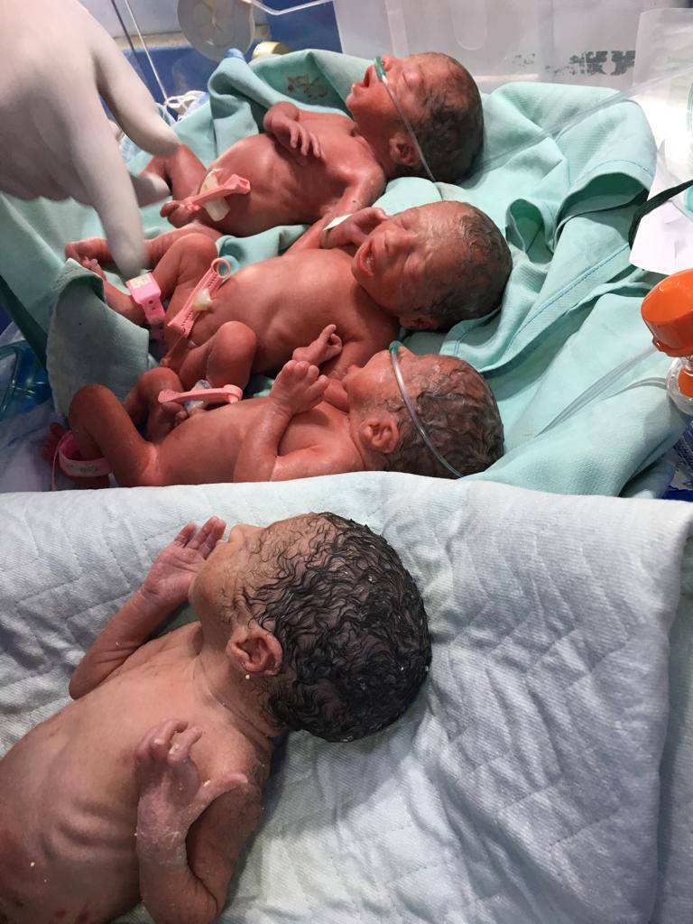 أردنية مصابة بكورونا تنجب 4 توائم