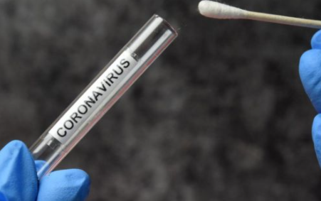 عاجل : أردنيون في مصر .. ندفع 100 دولار لفحص كورونا لـغايات السفر .. فلماذا لا تكون المعاملة بالمثل ؟