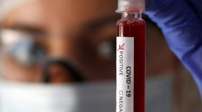 دراسة تنسف فرضية العلاقة بين كورونا و فصيلة الدم