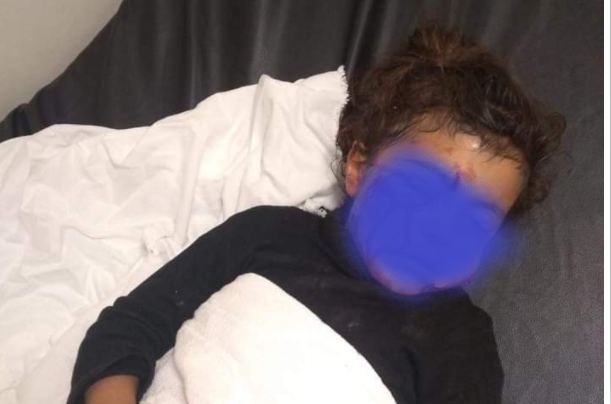 كلب ضال يعقر طفلة في المفرق