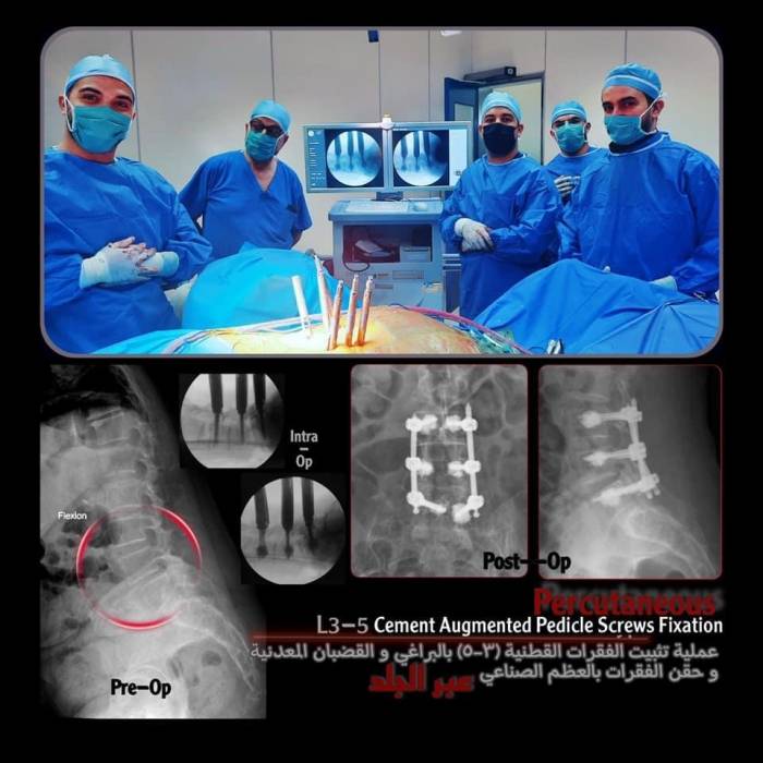 عملية نوعية في مستشفى ابن الهيثم