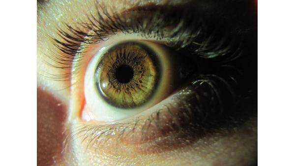 ارتفاع حالات التبرع بالقرنيات في مأدبا