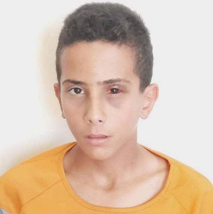 مدير التربية والتعليم للواء بني كنانه يعود الطالب أوس عبدالكريم