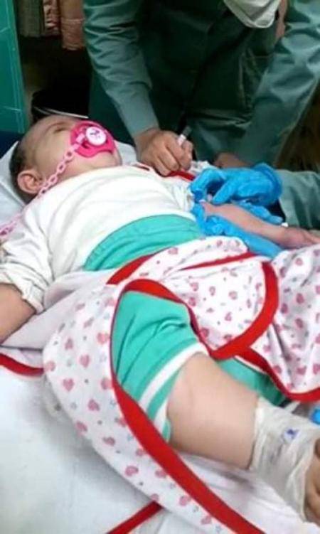 بعد فشل عملية جراحية .. طفلة تعاني ولا علاج لها في الأردن