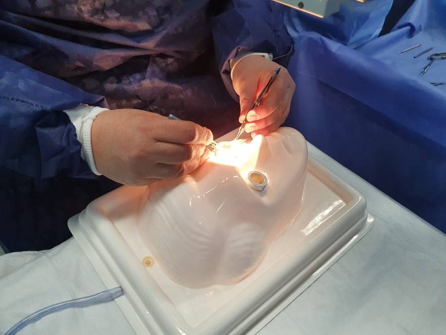 ورشة تدريبية لمقيمي طب وجراحة العيون في البشير